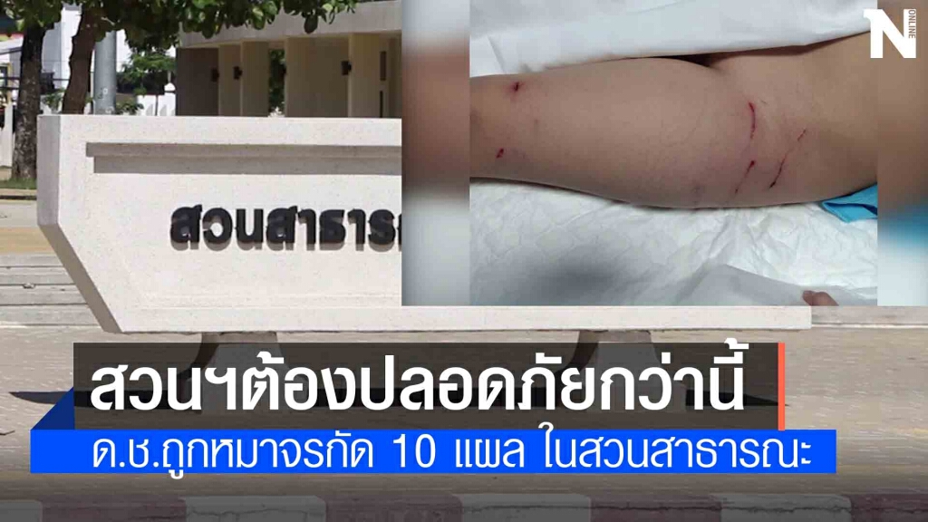 เตือนภัย! สุนัขจรจัดรุมกัดเด็กชายวัย 6 ขวบ