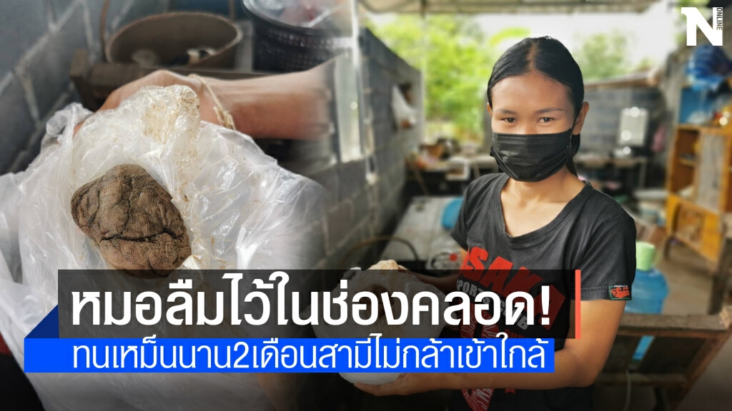 สาวแม่ลูกอ่อนผงะ! เจอผ้าก๊อซหลุดออกจากช่องคลอด
