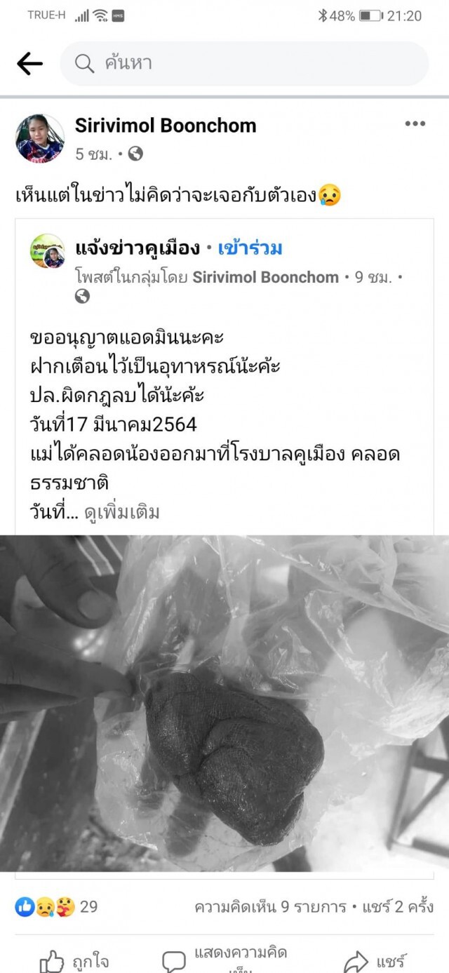 สาวแม่ลูกอ่อนผงะ! เจอผ้าก๊อซหลุดออกจากช่องคลอด