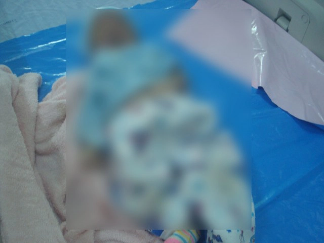 ทารกน้อย 25 วันขาดอากาศหายใจแม่รีบแจ้งกู้ชีพ