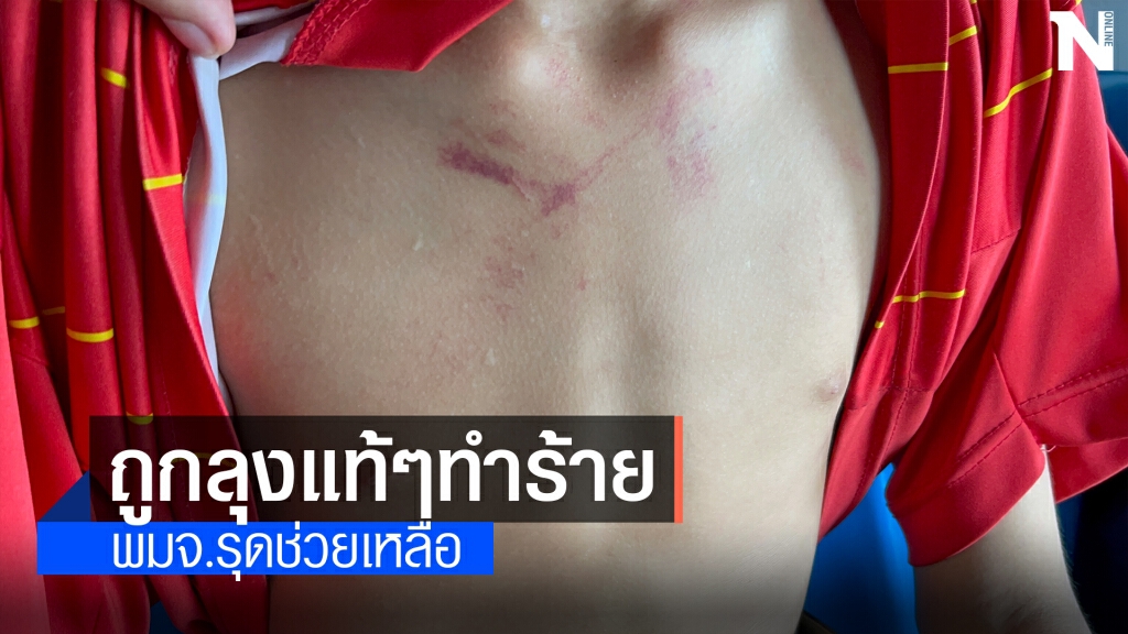 รุดช่วยเด็กชาย12ปี ถูกลุงทุบตีทำร้าย