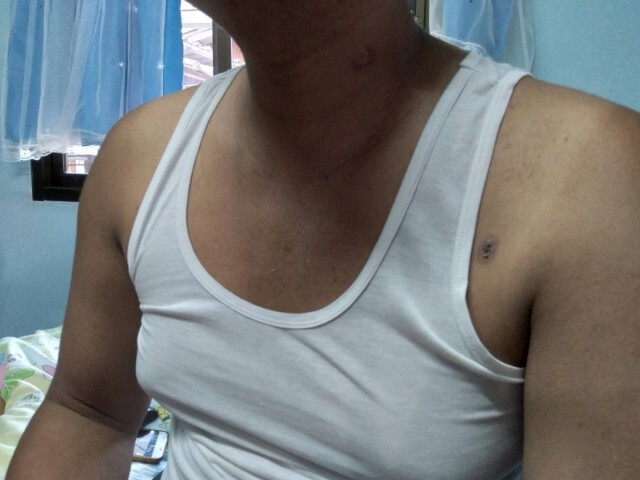 นายกอบต.บงตันวอนถูกยิงเกือบตายแต่คดีไม่คืบ