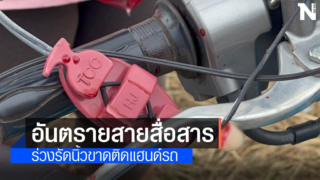 สายสื่อสารร่วงเกี่ยวแฮนด์ รถ จยย.รัดนิ้วมือขาด