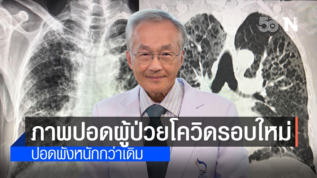 "หมอมนูญ" เปิดภาพเอกซเรย์ปอดผู้ป่วยโควิด ระลอกใหม่ ปอดพังหนักกว่าเดิม