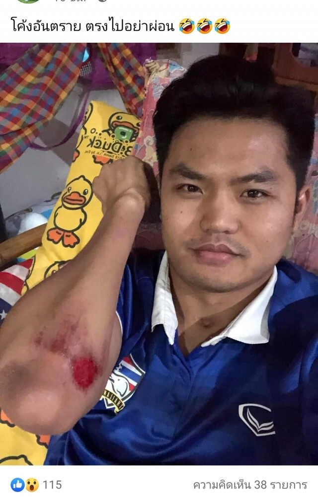 หนุ่มพิการคึกคะนองนำวีลแชร์ต่อหัวลากไฟฟ้าวิ่งบนถนนหลุดโค้งบาดเจ็บ