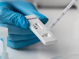 รัฐบาลใจดี แจกฟรี! Antigen Test Kit 8.5 ล้านชุด คาดเริ่มสิงหาคมนี้
