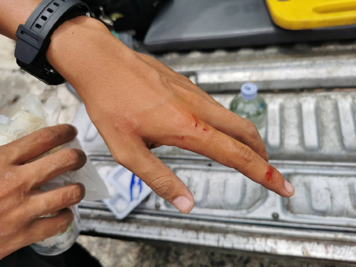 ช่วยแมวจรจัดขาติดกรงเหล็กหน้าต่างบ้าน กู้ภัยถูกกัดมือเลือดซิบ