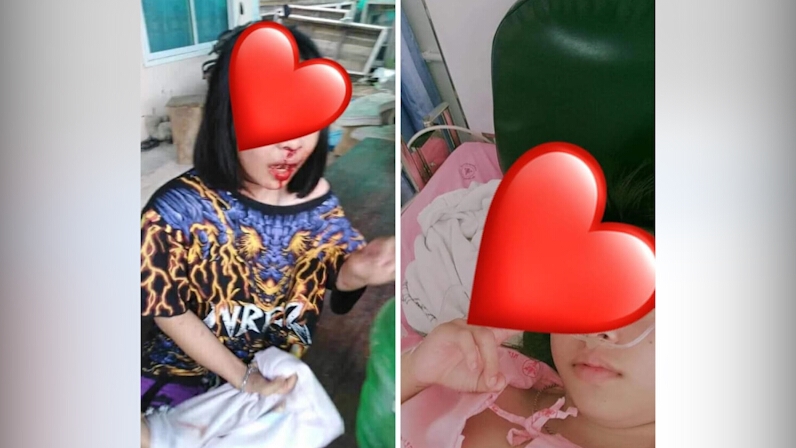 “ด.ญ.วัย 14 ปี” ถูกสาวสองพร้อมพวก บุกทำร้ายในบ้านเจ็บสาหัส