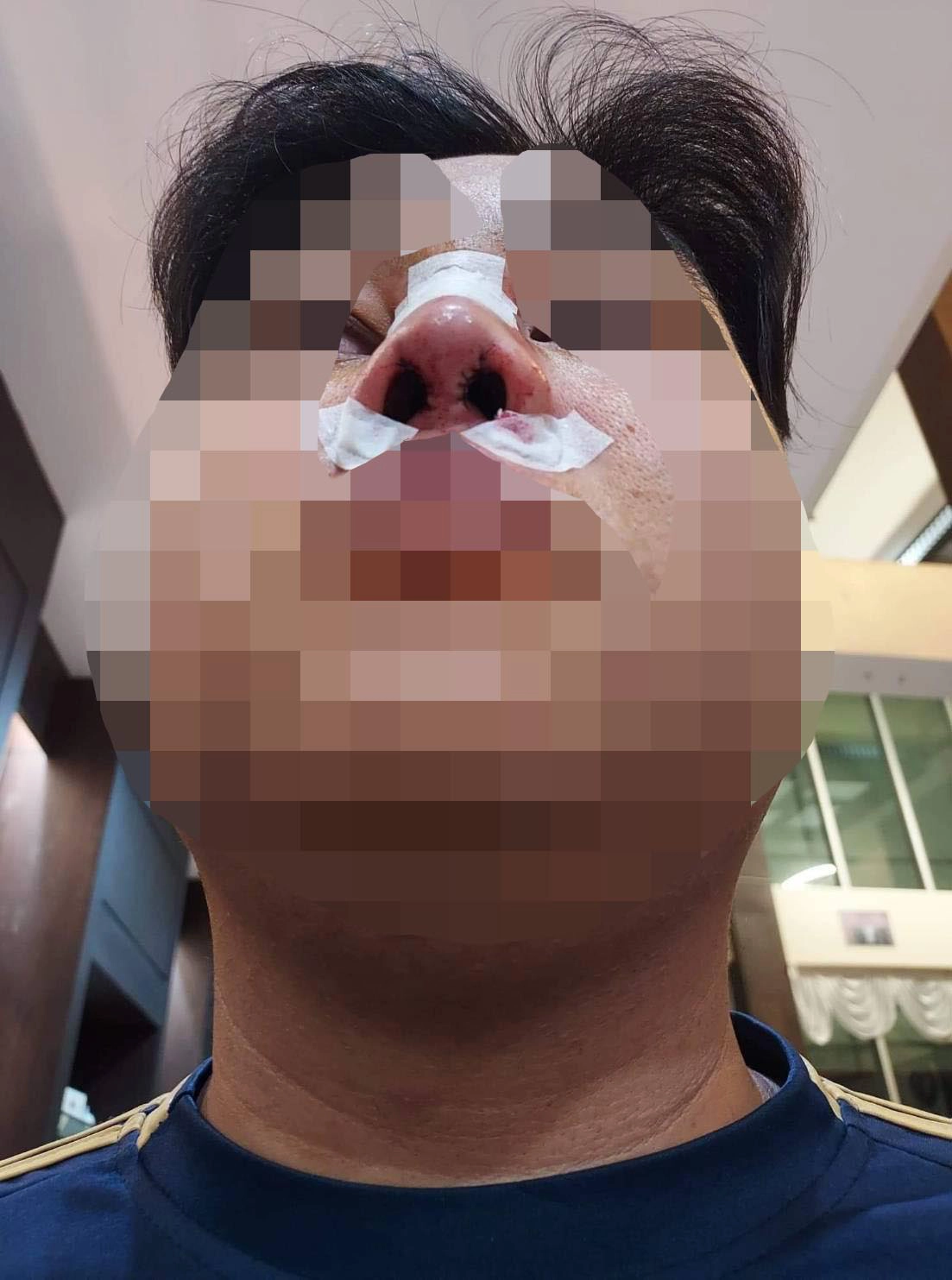 โร่แจ้งความเอาผิดคลินิกเสริมความงามเถื่อน-เตรียมร้องสคบ.