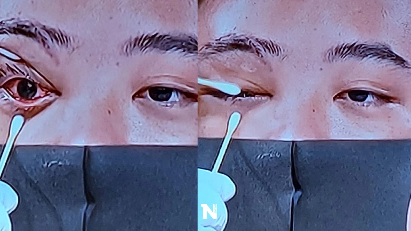 "ไฮโซลูกนัท"ถ่างตาโชว์จะจะที่เนชั่น ตาบอดหรีอไม่ดูเอา