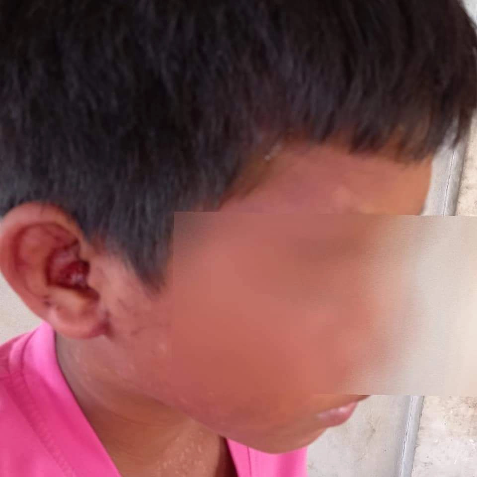 เพื่อนบ้านสุดทน โพสต์คลิปย่าตีหลานจนหูมีเลือดออก