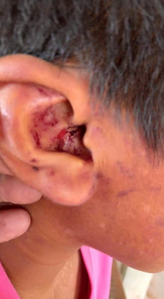 เพื่อนบ้านสุดทน โพสต์คลิปย่าตีหลานจนหูมีเลือดออก