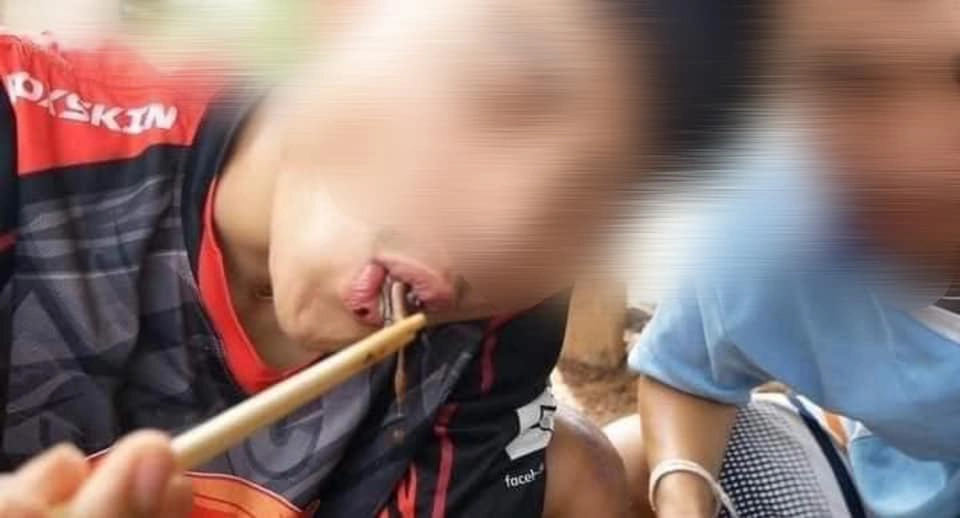 อย่าหาทำ! เตือนเปิบไส้เดือนดิบ แหล่งรวมเชื้อโรค