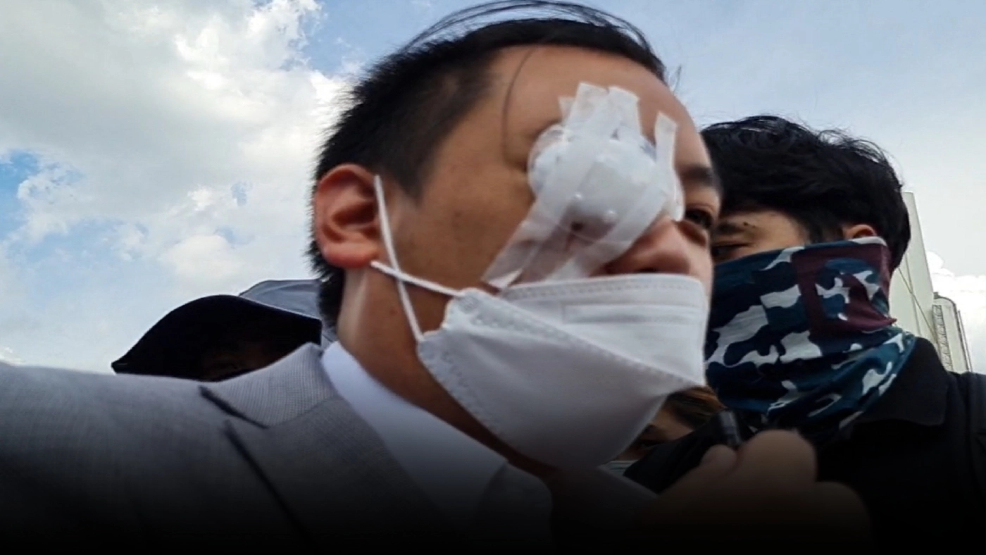 ไฮโซลูกนัทร่วมม็อบ 3 นิ้ว หลังตาบอด