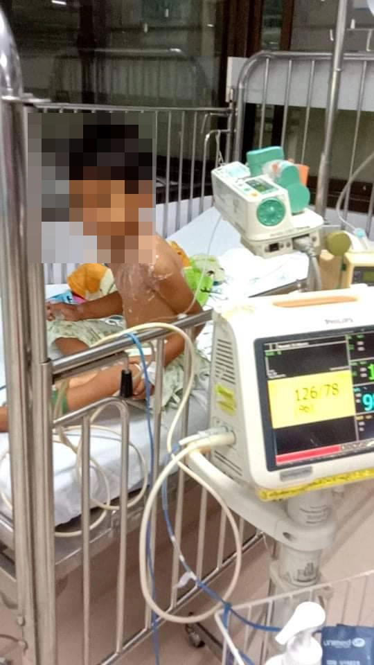 "ต่อหัวเสือ" แตกรังรุมต่อยเด็ก 3 ขวบสาหัส