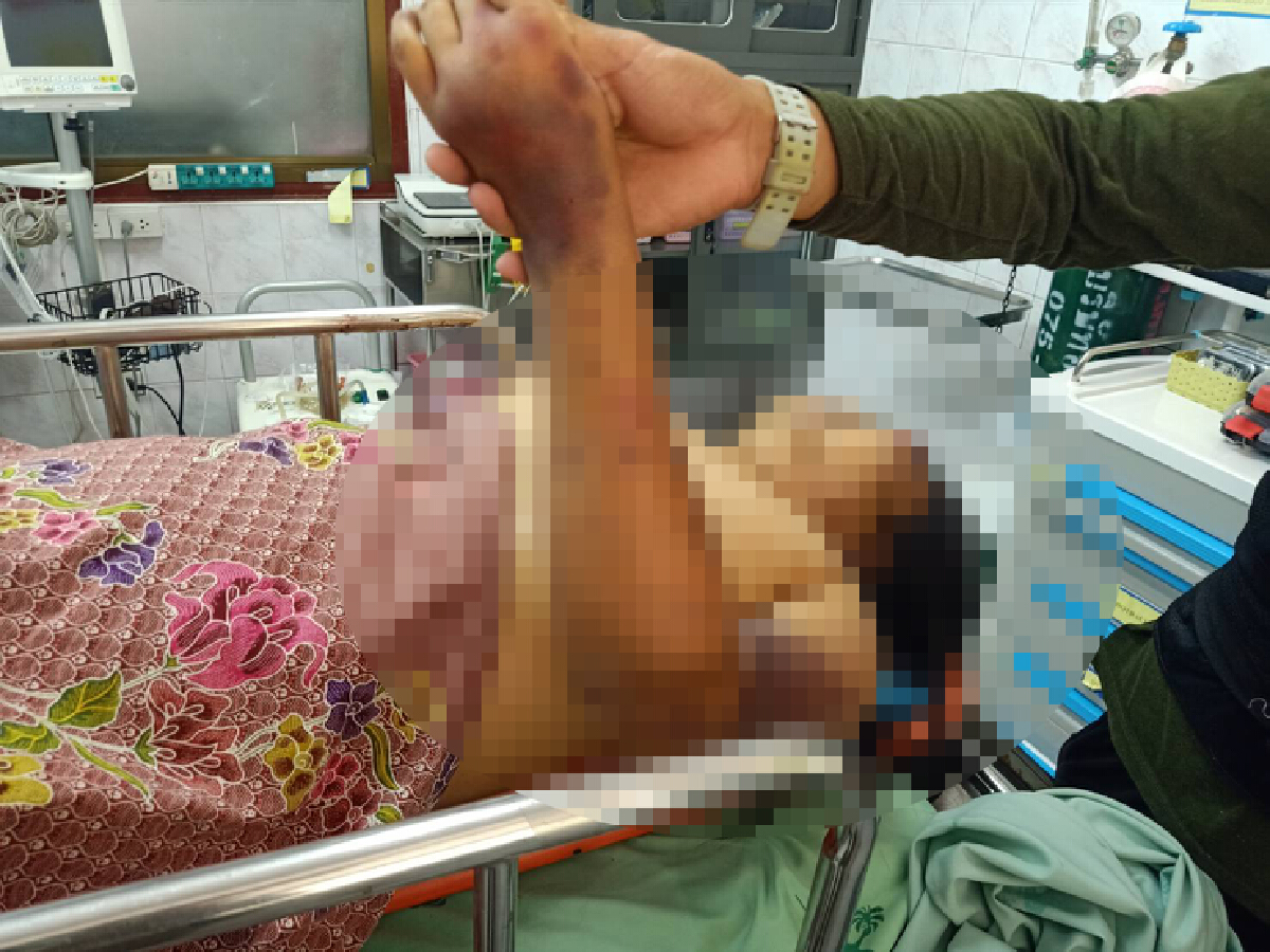 รวบผัวโหดกระทืบเมียดับ ซี่โครงหัก 15 ซี่
