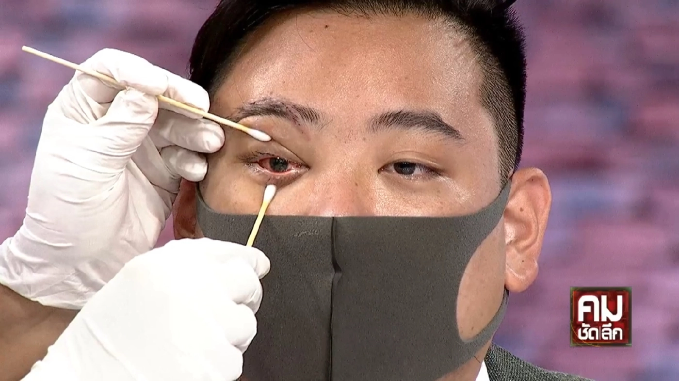 ไฮโซลูกนัทถ่างตาโชว์