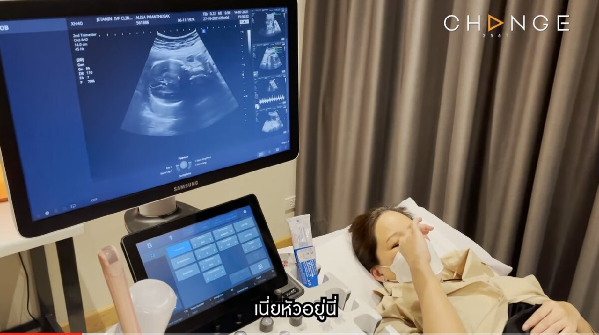 อั๋น ภูวนาท-จ๋า อลิสา เฉลยเพศลูกคนที่สอง ยันไม่คิดปิดเรื่องท้อง
