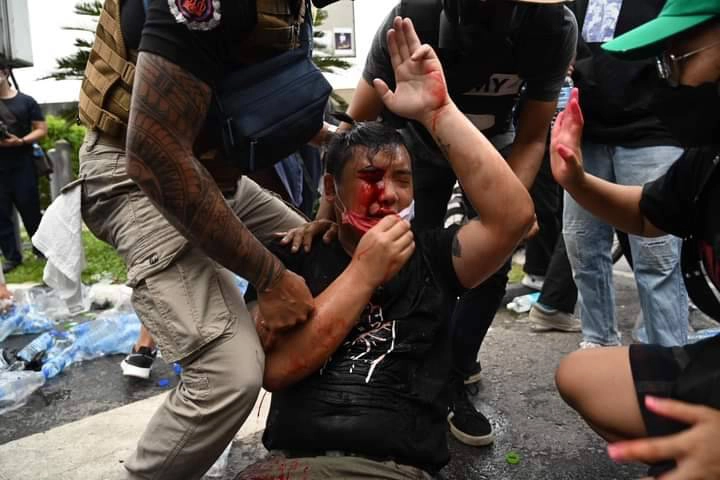 ลือหึ่ง! &quot;ไฮโซลูกนัท&quot; ตาบอดถูกยิงแก๊สน้ำตา