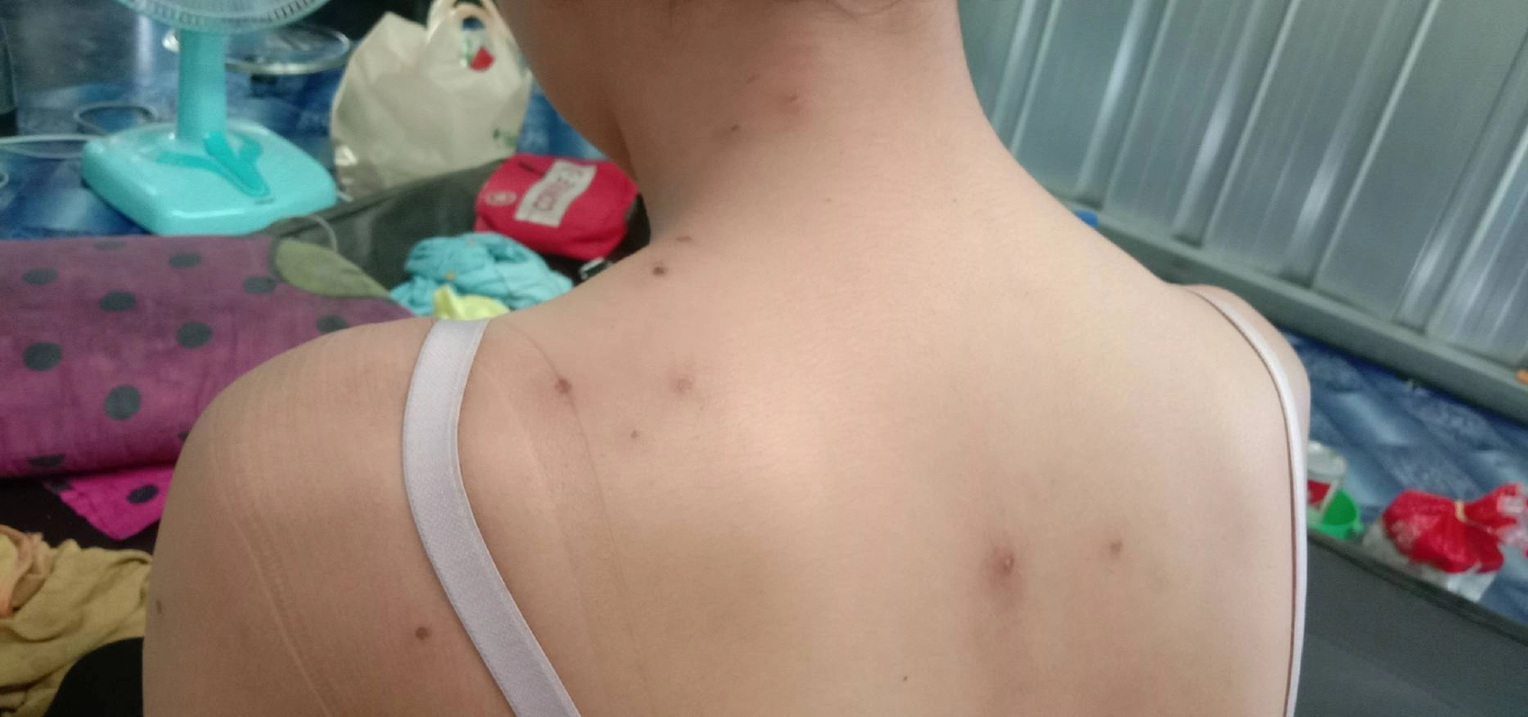 "ต่อหัวเสือ" แตกรังรุมต่อยเด็ก 3 ขวบสาหัส