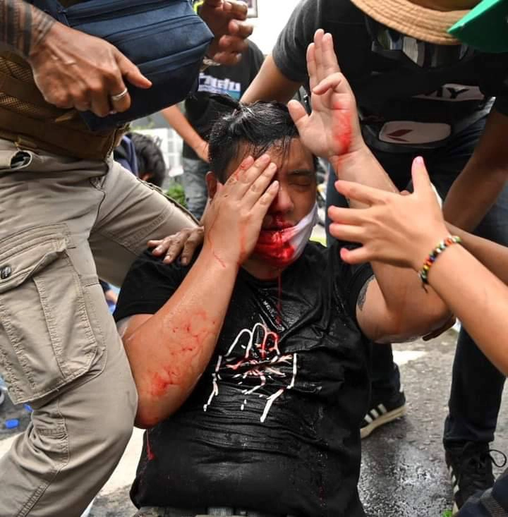 &quot;ไฮโซลูกนัท&quot; ร้องเพลงครั้งแรกหลังตาบอด 