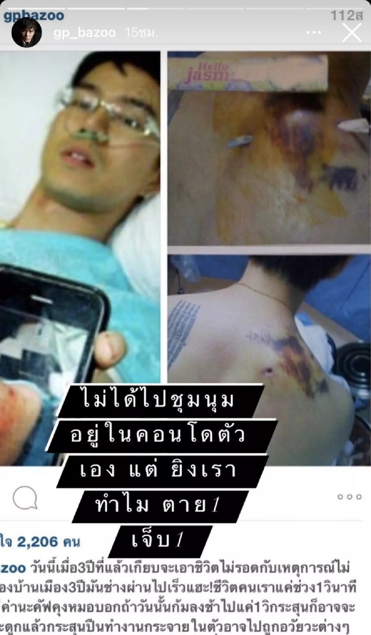 “กำปั้น บาซู” ขุดภาพโดนยิงเมื่อ 10 ปีแล้ว "ยังหาตัวคนผิดไม่ได้เลย"