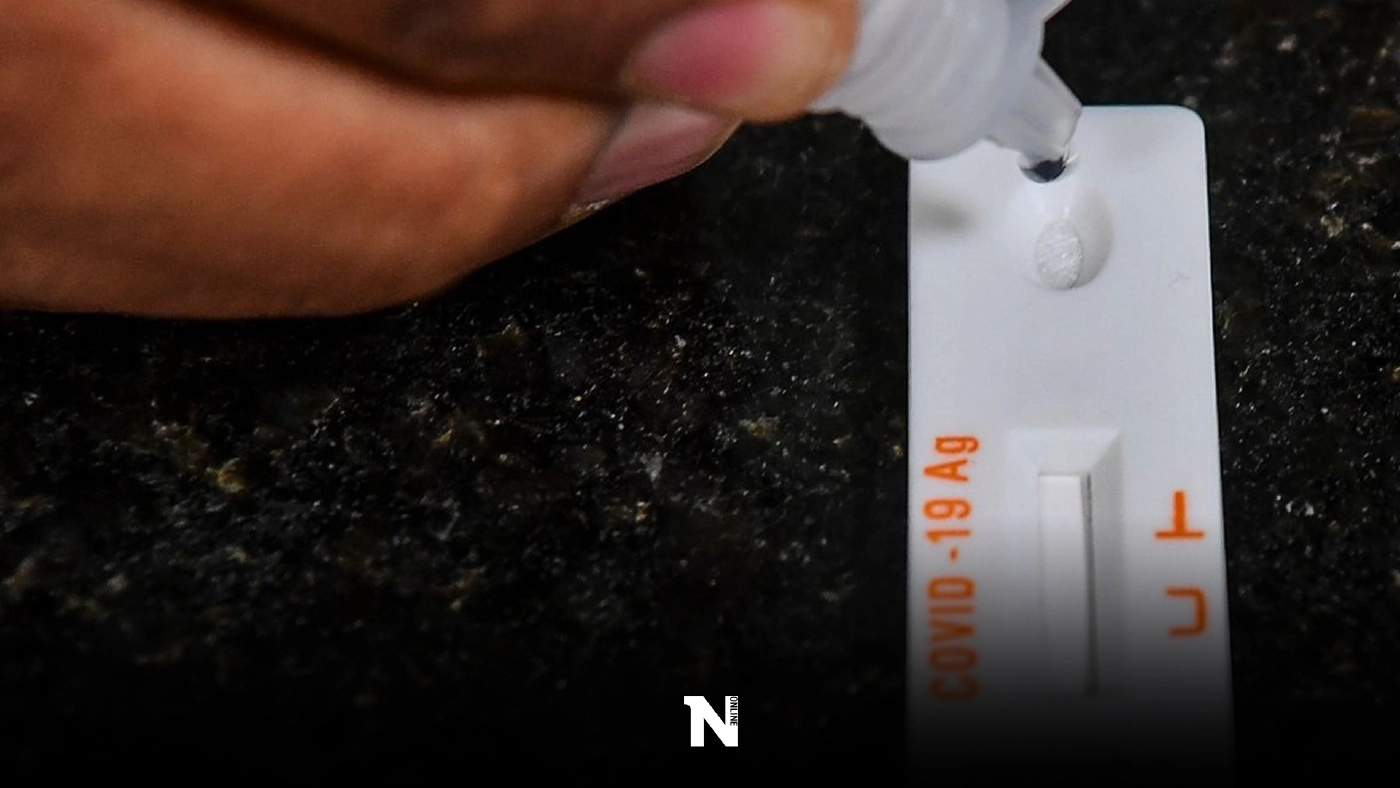 สปสช.ย้ำใช้ผลตรวจ RT-PCR เคลมประกันโควิดได้เลย ไม่ต้องใช้ใบรับรองแพทย์