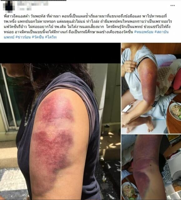 โพสต์ต้นเรื่อง