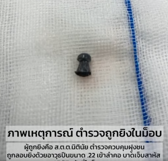 กระสุนที่จากผู้บาดเจ็บ