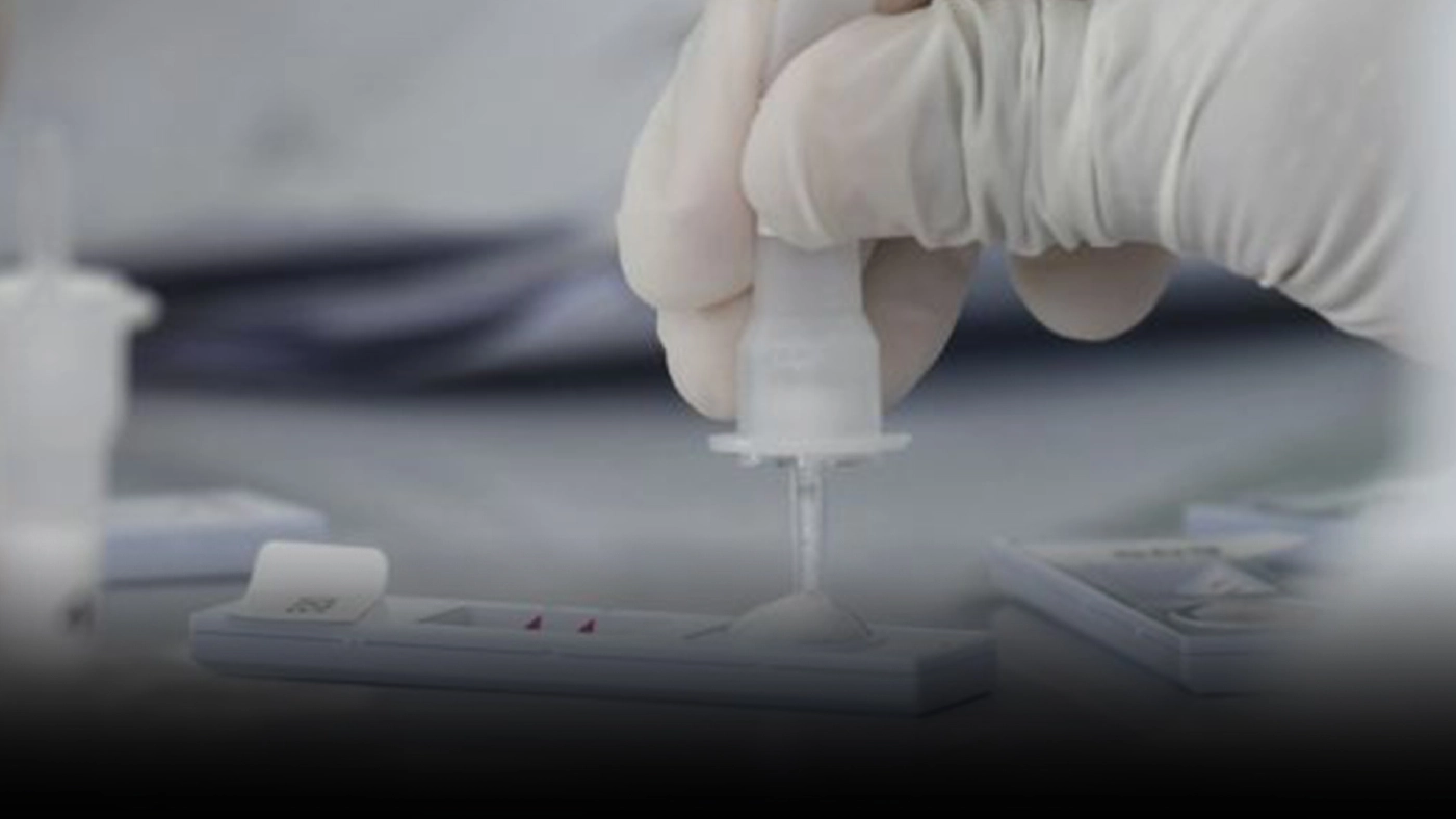 แถลงการณ์ ฉ.3 "แพทย์ชนบท" พร้อมตรวจสอบ ATK เจ้าปัญหา