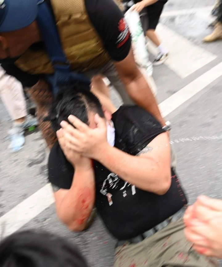 &quot;ไฮโซลูกนัท&quot; ร้องเพลงครั้งแรกหลังตาบอด 