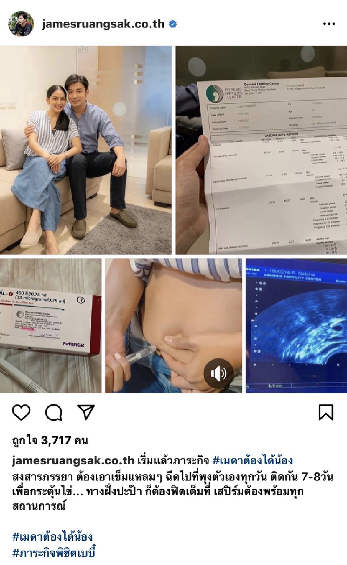 “เจมส์ - ครูก้อย” ฝากตัวอ่อนเตรียมความพร้อมมีทายาทคนที่สองต้นปีหน้า