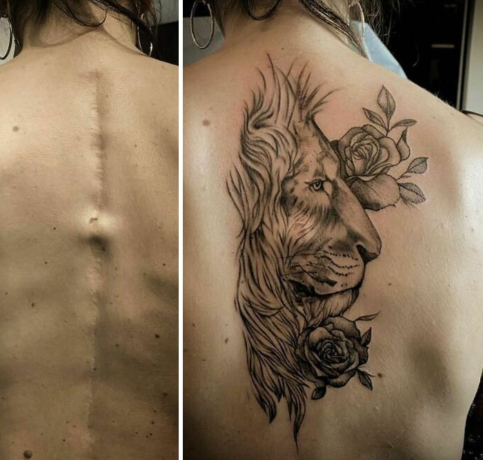 ลบรอยแผลจากฝันร้ายให้สวยด้วย "รอยสัก"