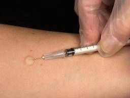 เตือน! ฉีดสารแปลกปลอมเข้าผิวหนัง "หมดสวยเสี่ยงอันตราย อาจติดเชื้อระยะยาว"