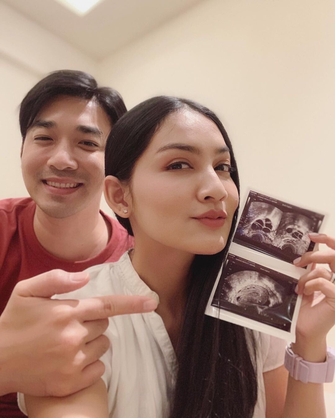 “เจมส์ - ครูก้อย” ฝากตัวอ่อนเตรียมความพร้อมมีทายาทคนที่สองต้นปีหน้า