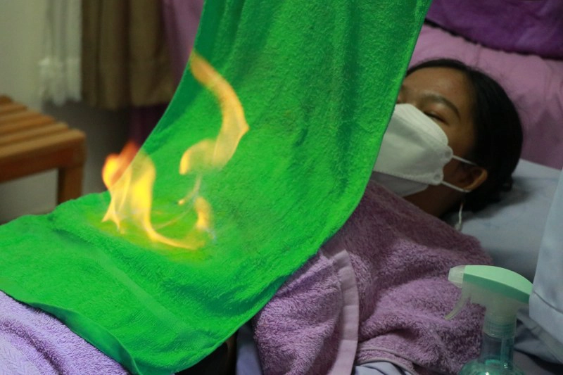 ดันท่องเที่ยวเชิงสุขภาพ-โชว์เผาสมุนไพรหน้าท้อง