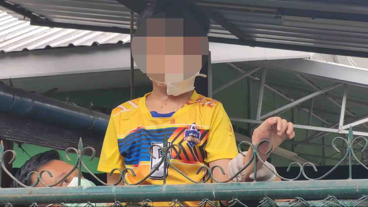 เด็ก11ขวบซนไล่จับแมว-พลัดตกถูกเหล็กเสียบมือเจ็บ