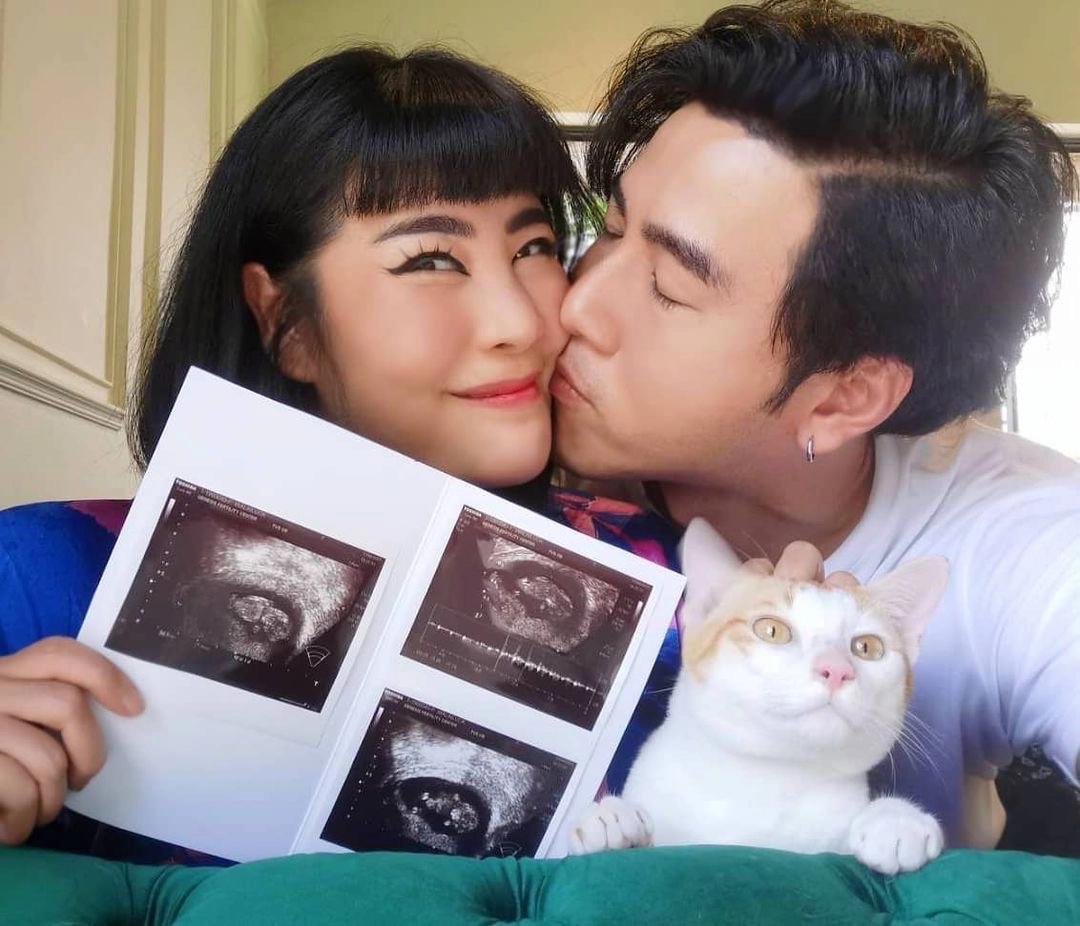 “โย่ง อาร์มแชร์”อวดภาพอัลตราซาวด์ทายาทคนแรกหลังครบ 32 สัปดาห์