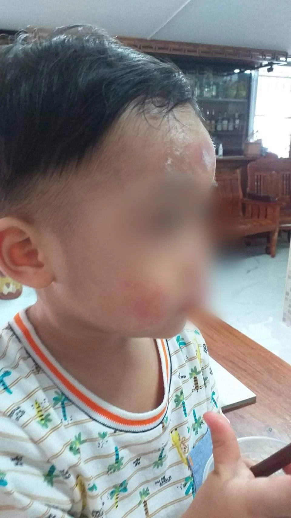 แม่ร้องสื่อลูกขวบ 9 เดือนถูกเพื่อนทำร้ายขอดูวงจรปิดบอกกล้องเสีย