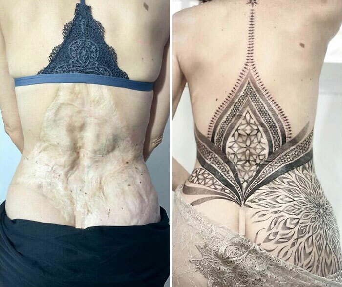 ลบรอยแผลจากฝันร้ายให้สวยด้วย "รอยสัก"