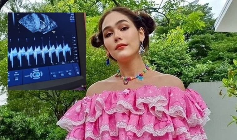 "ชมพู่ " เผย เตรียมให้คู่แฝด สายฟ้า-พายุ ดรอปเรียนออนไลน์