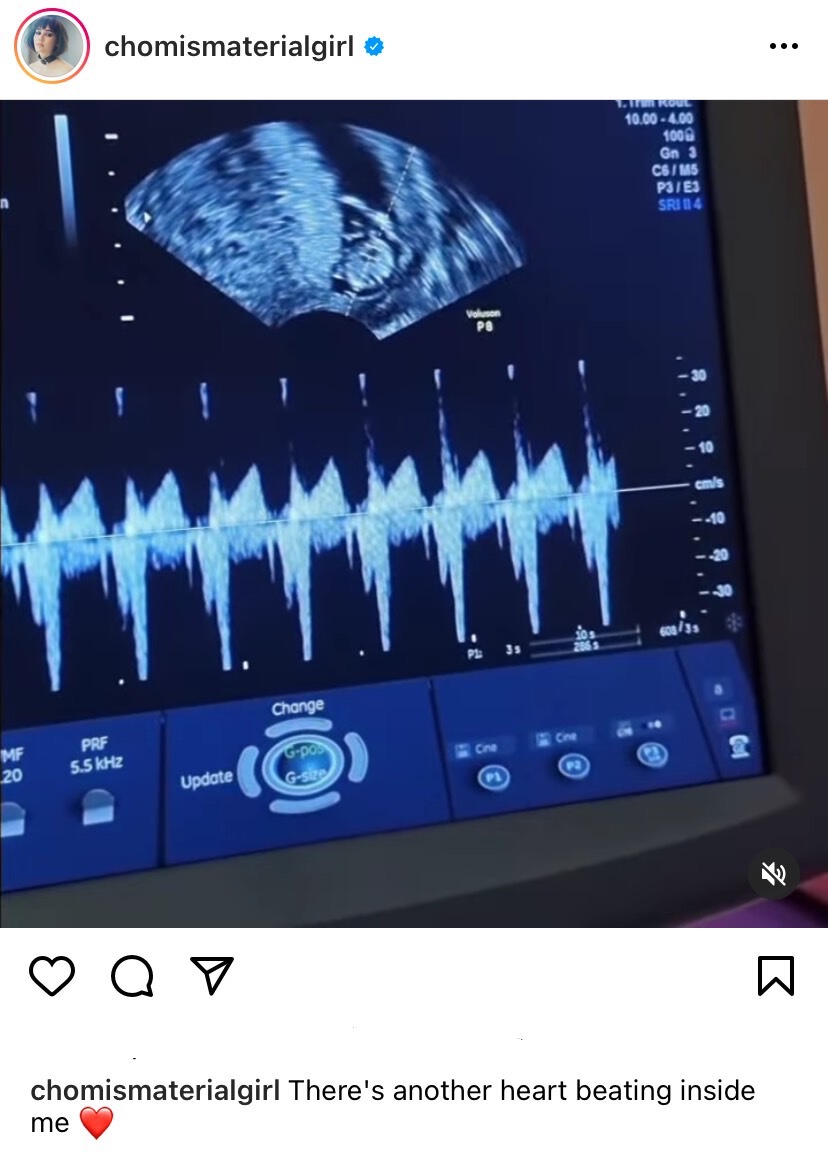 “ชมพู่ อารยา”ประกาศข่าวดีตั้งท้องลูกคนที่สาม
