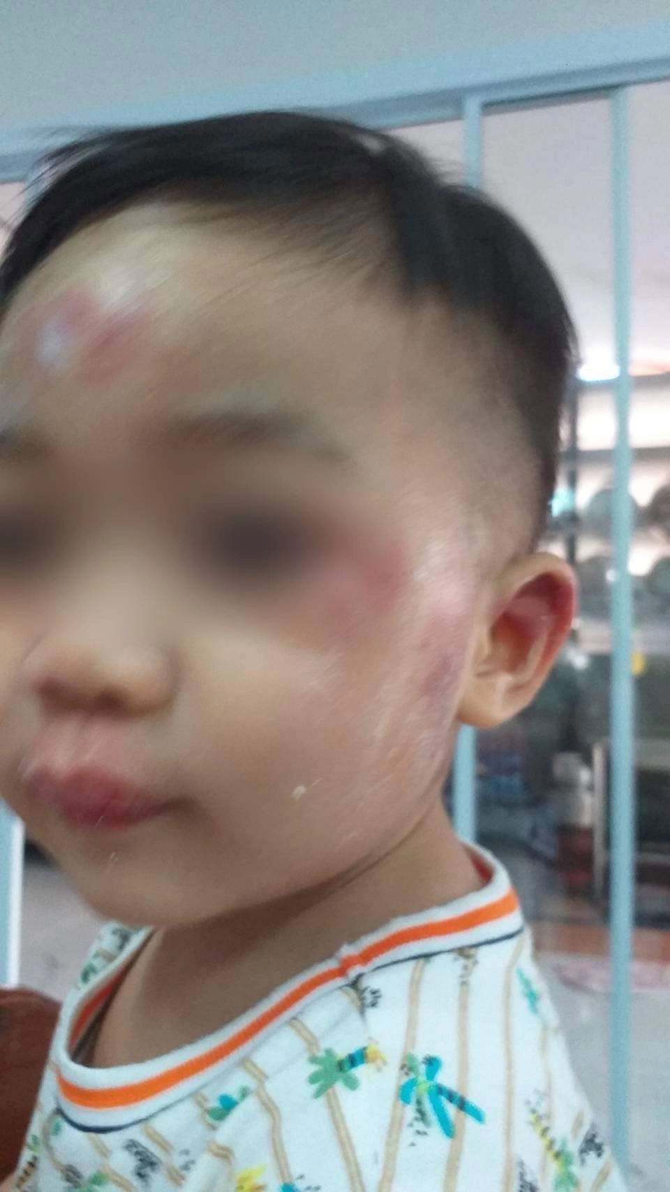 แม่ร้องสื่อลูกขวบ 9 เดือนถูกเพื่อนทำร้ายขอดูวงจรปิดบอกกล้องเสีย