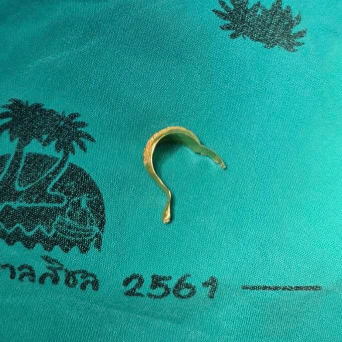 อุทาหรณ์! ยายรับขวัญหลาน 3 ขวบ ใส่แหวนทองให้สุดท้ายถอดไม่ออกต้องผ่าตัด