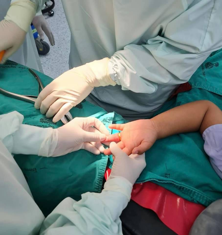 อุทาหรณ์! ยายรับขวัญหลาน 3 ขวบ ใส่แหวนทองให้สุดท้ายถอดไม่ออกต้องผ่าตัด