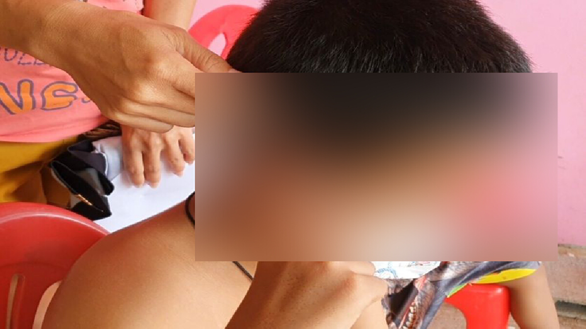 พ่อเลี้ยงทุบตีลูกเลี้ยงวัย 8ขวบและภรรยา เขียวช้ำทั้งตัว