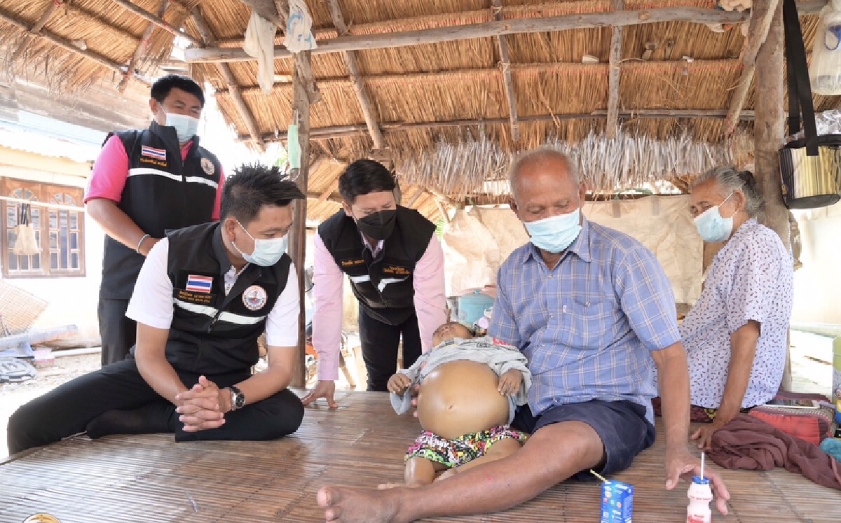 เด็กชายท้องโตถูกส่งรพ.ศิริราชหวังปลูกถ่ายตับ