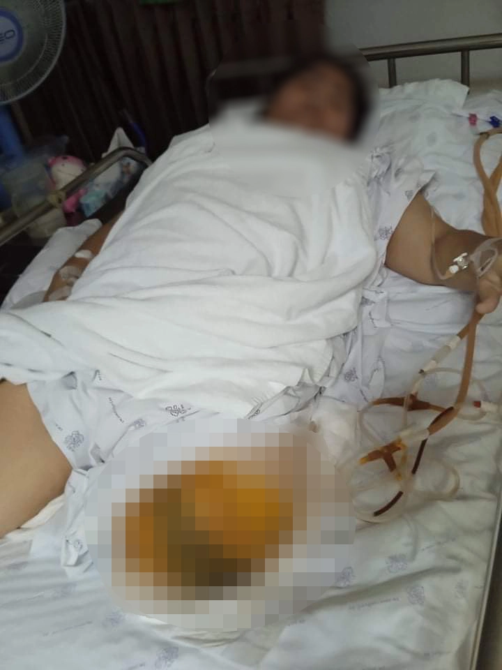 ญาติเชื่อ นศ.ถูกตัดขาเพราะวัคซีนแอสตร้าเข็ม 2 แบบไขว้