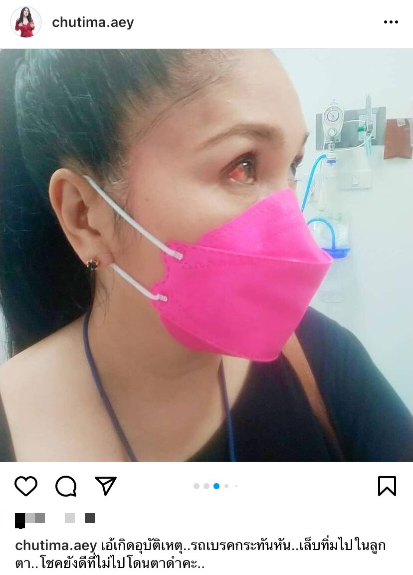 "เอ้ ชุติมา"  หวิดตาบอดเกิดอุบัติเหตุ รถเบรคกระทันหัน