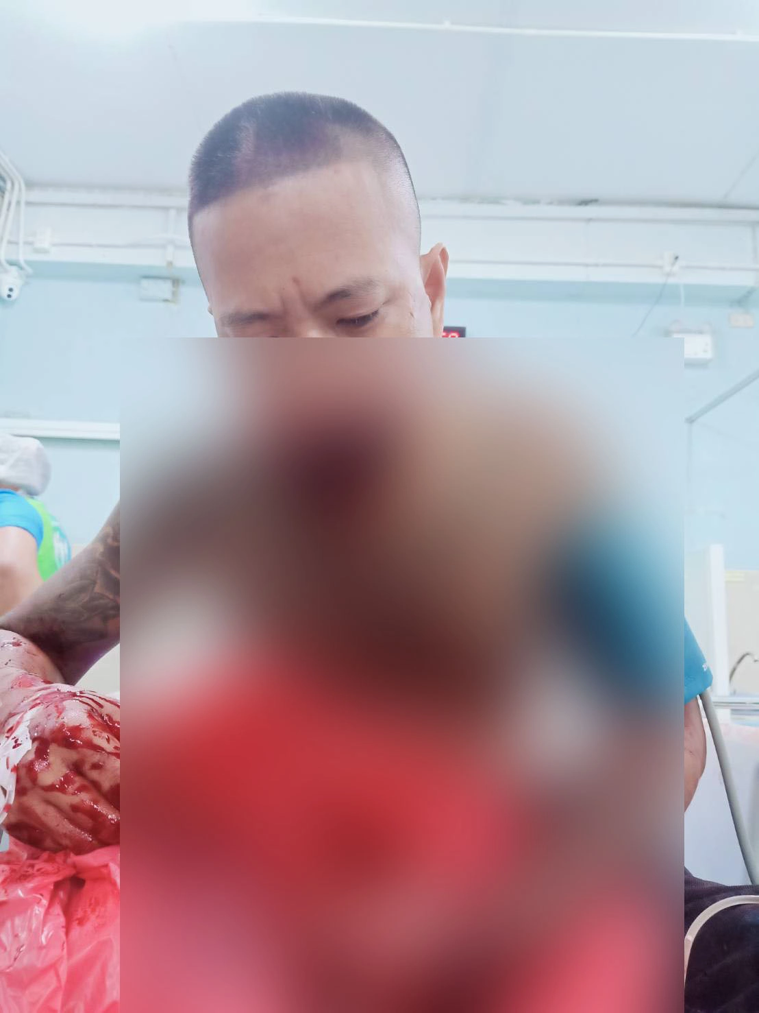 อดีตทหารพราน ลองของอมประทัดลูกบอลโชว์ ระเบิดใส่ปากเละ